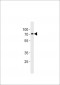 ST7L Antibody (C-term)